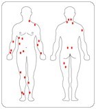 spots-on-the-body